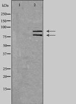 hnRNP M Antibody in Western Blot (WB)