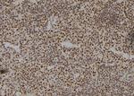 HOXA11 Antibody in Immunohistochemistry (Paraffin) (IHC (P))