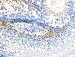 HSD11B1 Antibody in Immunohistochemistry (Paraffin) (IHC (P))