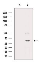 HSD11B1 Antibody in Western Blot (WB)