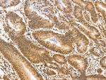 HAS2 Antibody in Immunohistochemistry (Paraffin) (IHC (P))