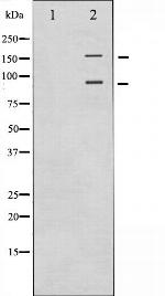 IGF1R alpha Antibody in Western Blot (WB)