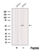 Heavy chain of IgG4 Antibody in Western Blot (WB)