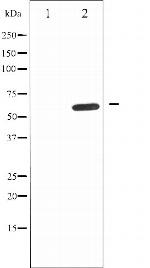 IL10RA Antibody in Western Blot (WB)