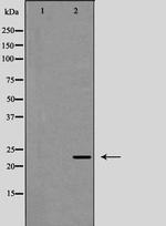 IL-12 p70 Antibody in Western Blot (WB)