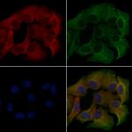 CD218a (IL-18Ra) Antibody in Immunocytochemistry (ICC/IF)