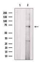 CD218a (IL-18Ra) Antibody in Western Blot (WB)