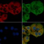 IL-21 Antibody in Immunocytochemistry (ICC/IF)