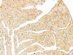 IL-22 Receptor alpha Antibody in Immunohistochemistry (Paraffin) (IHC (P))