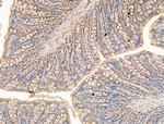 IL-22 Receptor alpha Antibody in Immunohistochemistry (Paraffin) (IHC (P))