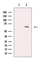 IL-22 Receptor alpha Antibody in Western Blot (WB)