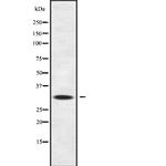 IL22RA2 Antibody in Western Blot (WB)