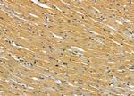 IL1RL2 Antibody in Immunohistochemistry (Paraffin) (IHC (P))