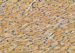 IL1RL2 Antibody in Immunohistochemistry (Paraffin) (IHC (P))