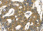 IL1RL2 Antibody in Immunohistochemistry (Paraffin) (IHC (P))