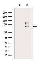 IL1RL2 Antibody in Western Blot (WB)