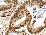 Importin 7 Antibody in Immunohistochemistry (Paraffin) (IHC (P))