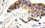 INSR Antibody in Immunohistochemistry (Paraffin) (IHC (P))