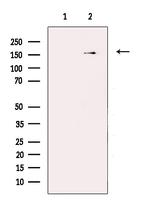 INSR Antibody in Western Blot (WB)