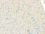 ITGA5 Antibody in Immunohistochemistry (Paraffin) (IHC (P))