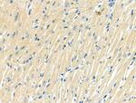 ITGA5 Antibody in Immunohistochemistry (Paraffin) (IHC (P))