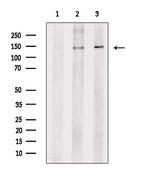 ITGA5 Antibody in Western Blot (WB)