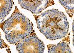 IFN alpha Antibody in Immunohistochemistry (Paraffin) (IHC (P))