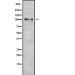 ITCH / AIP4 Antibody in Western Blot (WB)