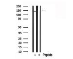 JAK1 Antibody in Western Blot (WB)