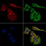 Kappa Light Chain Antibody in Immunocytochemistry (ICC/IF)