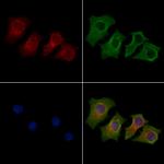 KVbeta2 (KCNAB2) Antibody in Immunocytochemistry (ICC/IF)