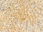 KVbeta2 (KCNAB2) Antibody in Immunohistochemistry (Paraffin) (IHC (P))