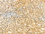 KVbeta2 (KCNAB2) Antibody in Immunohistochemistry (Paraffin) (IHC (P))