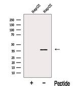 KVbeta2 (KCNAB2) Antibody in Western Blot (WB)