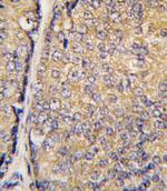 STAP1 Antibody in Immunohistochemistry (Paraffin) (IHC (P))