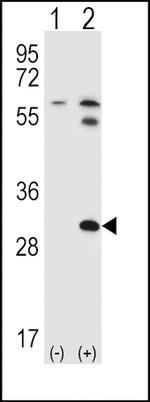 STAP1 Antibody in Western Blot (WB)