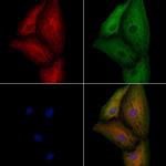 KCNK9 Antibody in Immunocytochemistry (ICC/IF)