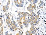 KCNK9 Antibody in Immunohistochemistry (Paraffin) (IHC (P))