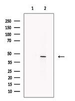 KCNK9 Antibody in Western Blot (WB)