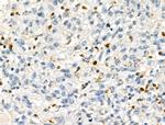 JMJD2A Antibody in Immunohistochemistry (Paraffin) (IHC (P))