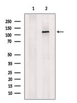 JMJD2A Antibody in Western Blot (WB)