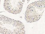 JARID1C Antibody in Immunohistochemistry (Paraffin) (IHC (P))