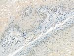 KIF17 Antibody in Immunohistochemistry (Paraffin) (IHC (P))