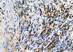 KIF4A Antibody in Immunohistochemistry (Paraffin) (IHC (P))