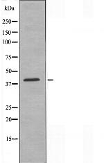 Herpes Simplex Virus Type 1 Antibody in Western Blot (WB)