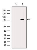 Herpes Simplex Virus Type 1 (strain 17) Antibody in Western Blot (WB)