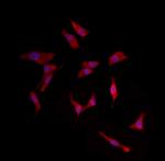 Herpes Simplex Virus Type 1 (strain SC16) Antibody in Immunocytochemistry (ICC/IF)