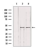 Herpes Simplex Virus Type 1 (strain SC16) Antibody in Western Blot (WB)