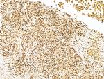 KLF2 Antibody in Immunohistochemistry (Paraffin) (IHC (P))