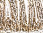 KLF2 Antibody in Immunohistochemistry (Paraffin) (IHC (P))